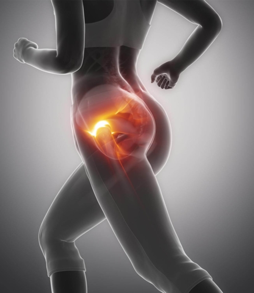 Sportverletzungen Sporttraumatologie